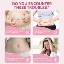 Yurhersu Pregnancy Cream Art.9799